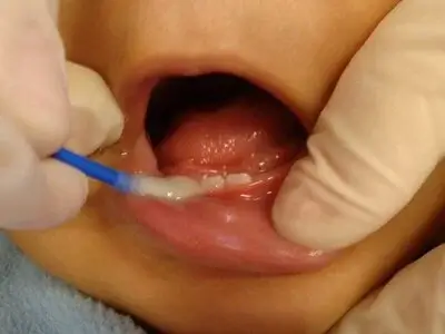 Child Dentistry