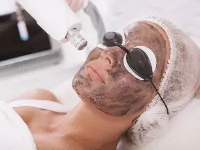 Laser Skin Treatments